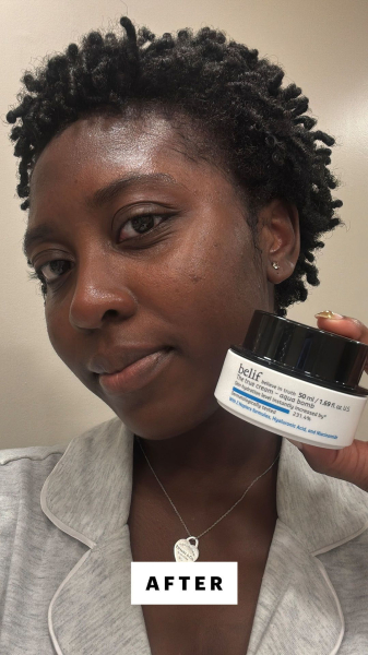 Annie BlayTettey after applying the Belif The True Cream Aqua Bomb